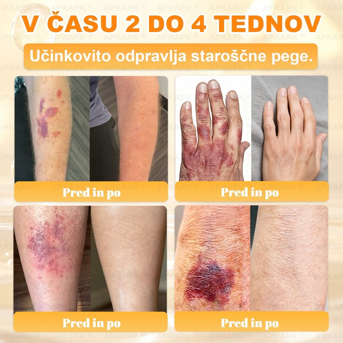 🍃Časovno omejena ponudba⏰✨APKAPK® krema za obnovo kože in odpravljanje gub z uporabo čebeljega strupa🍃Ciljna rešitev za gube in različne težave s kožo.