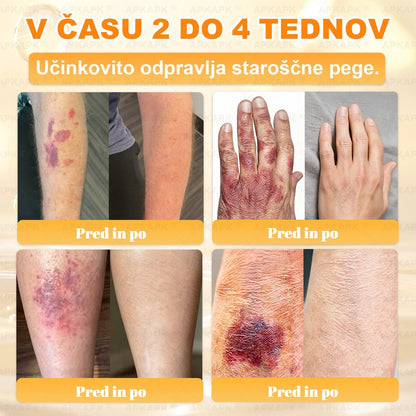 🍃Časovno omejena ponudba⏰✨APKAPK® krema za obnovo kože in odpravljanje gub z uporabo čebeljega strupa🍃Ciljna rešitev za gube in različne težave s kožo.