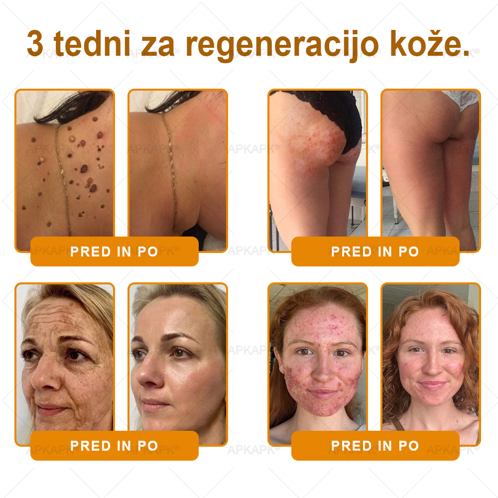 🎁 Na voljo je samo še 5 paketov! Zdaj prejmete dodatnih 50% popusta! Ostanite zdravi. Če te priložnosti ne izkoristite zdaj, bo naslednja šele prihodnje leto!