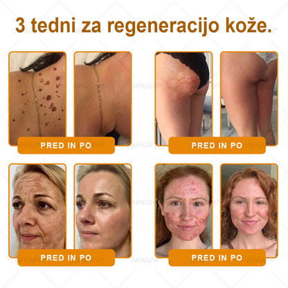 🎁 Na voljo je samo še 5 paketov! Zdaj prejmete dodatnih 50% popusta! Ostanite zdravi. Če te priložnosti ne izkoristite zdaj, bo naslednja šele prihodnje leto!