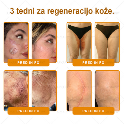 🍃Časovno omejena ponudba⏰✨APKAPK® krema za obnovo kože in odpravljanje gub z uporabo čebeljega strupa🍃Ciljna rešitev za gube in različne težave s kožo.