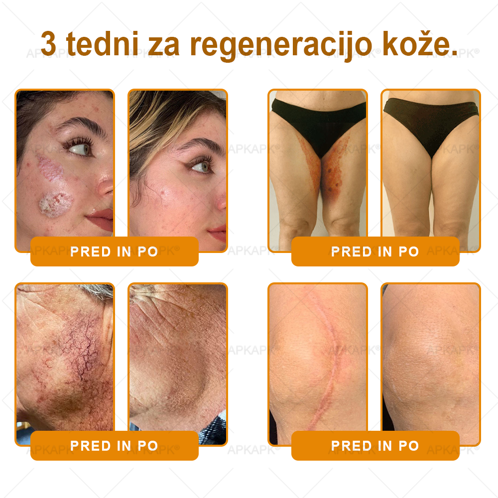 🎁 Na voljo je samo še 5 paketov! Zdaj prejmete dodatnih 50% popusta! Ostanite zdravi. Če te priložnosti ne izkoristite zdaj, bo naslednja šele prihodnje leto!