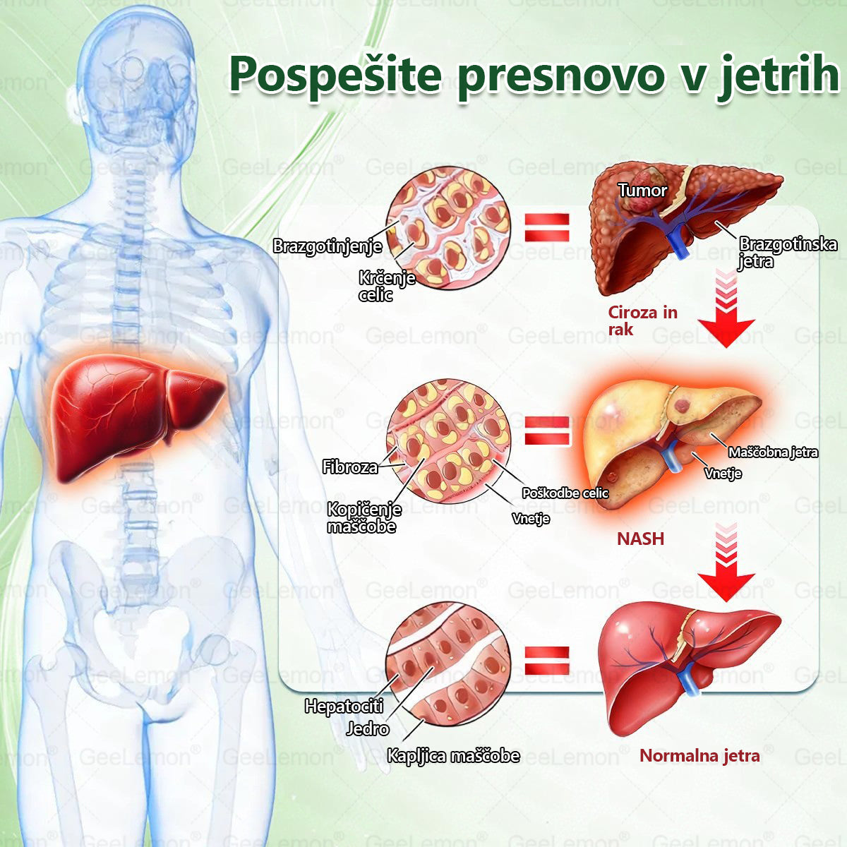 🌴🌴Registrirano pri JAZMP in GMP certificirano👩‍⚕️🎁 𝐆𝐞𝑒𝐿𝑒𝐦𝐨𝐧® 𝐆𝐥𝐮𝐦𝐚𝐬𝐞𝐭𝐢𝐝𝐞 8 v 1 Hujševalni in zdravju namenjen nano obliž z mikroiglicami 🇸🇮 (Samo enkrat na dan, vidne spremembe že v 7 dneh) ✅