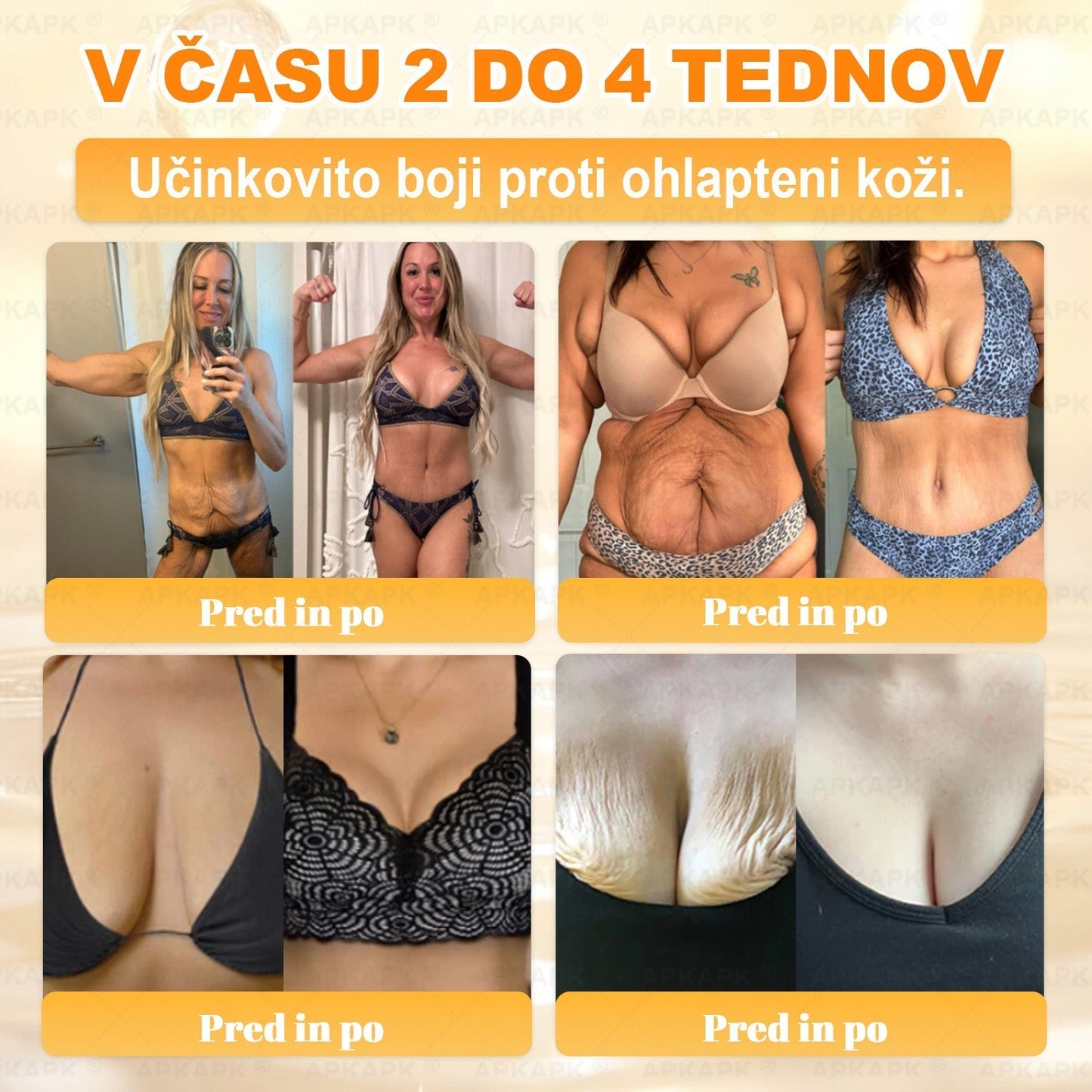 🎁 Na voljo je samo še 5 paketov! Zdaj prejmete dodatnih 50% popusta! Ostanite zdravi. Če te priložnosti ne izkoristite zdaj, bo naslednja šele prihodnje leto!