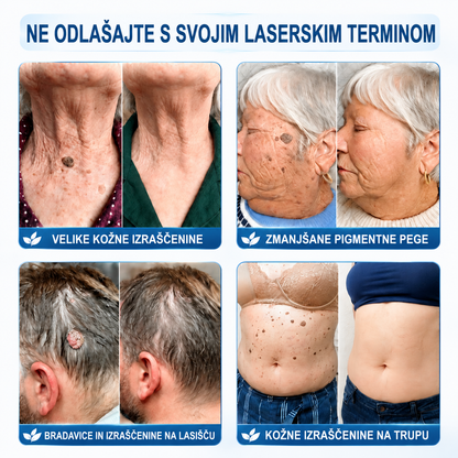 👩‍⚕️👩‍⚕️Uradna trgovina|✅️👩‍⚕️𝐇𝐈𝐒𝐊𝐈𝐍®7 dnevni odstranjevalec kožnih izrastkov in madežev(𝐫𝐨𝐥𝐥-𝐨𝐧 𝐚𝐩𝐥𝐢𝐤𝐚𝐭𝐨𝐫: 𝐛𝐫𝐞𝐳 𝐛𝐨𝐥𝐞č𝐢𝐧 𝐢𝐧 𝐛𝐫𝐚𝐳𝐠𝐨𝐭𝐢𝐧)🌳