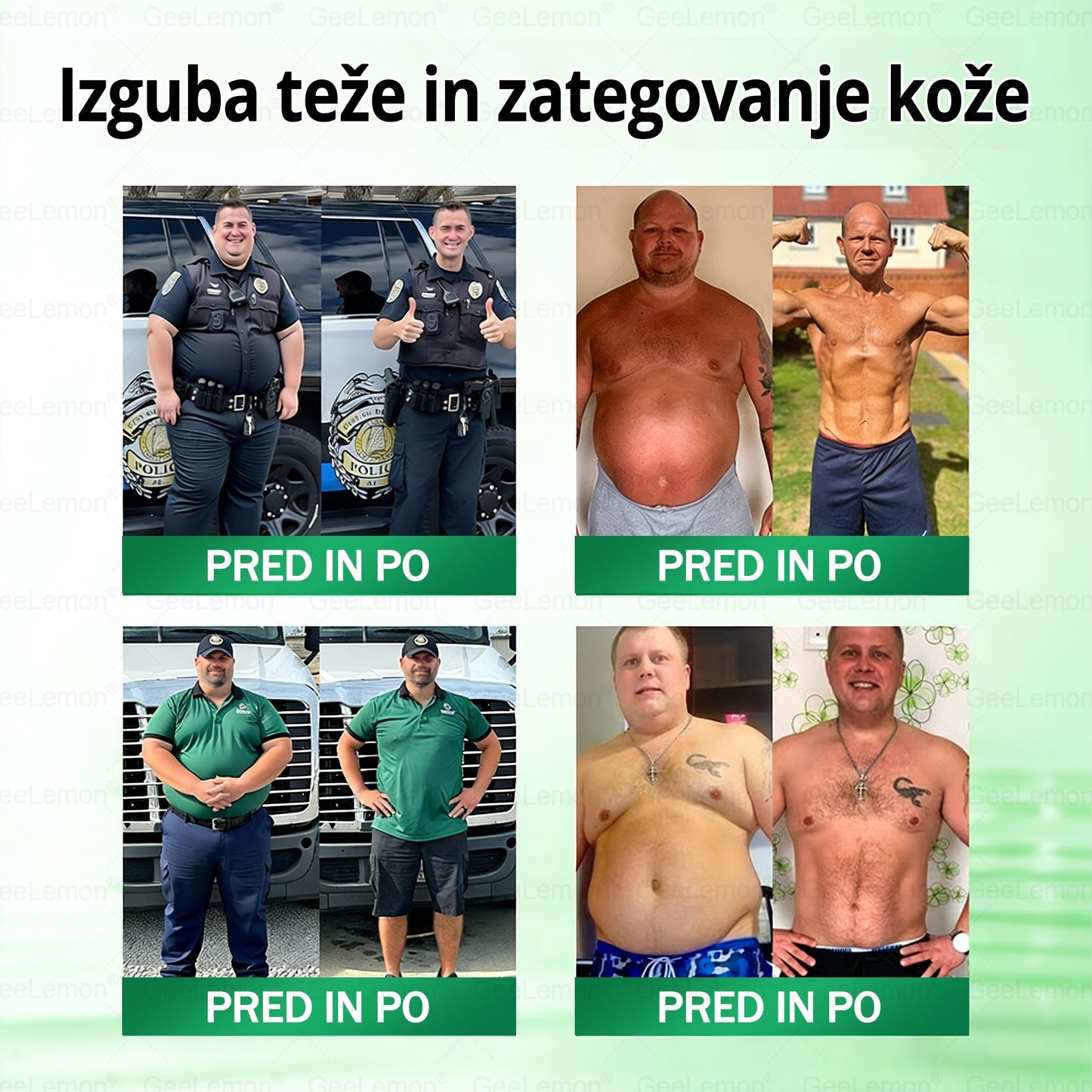 🌴🌴Registrirano pri JAZMP in GMP certificirano👩‍⚕️🎁 𝐆𝐞𝑒𝐿𝑒𝐦𝐨𝐧® 𝐆𝐥𝐮𝐦𝐚𝐬𝐞𝐭𝐢𝐝𝐞 8 v 1 Hujševalni in zdravju namenjen nano obliž z mikroiglicami 🇸🇮 (Samo enkrat na dan, vidne spremembe že v 7 dneh) ✅