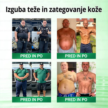 🌴🌴Registrirano pri JAZMP in GMP certificirano👩‍⚕️🎁 𝐆𝐞𝑒𝐿𝑒𝐦𝐨𝐧® 𝐆𝐥𝐮𝐦𝐚𝐬𝐞𝐭𝐢𝐝𝐞 8 v 1 Hujševalni in zdravju namenjen nano obliž z mikroiglicami 🇸🇮 (Samo enkrat na dan, vidne spremembe že v 7 dneh) ✅