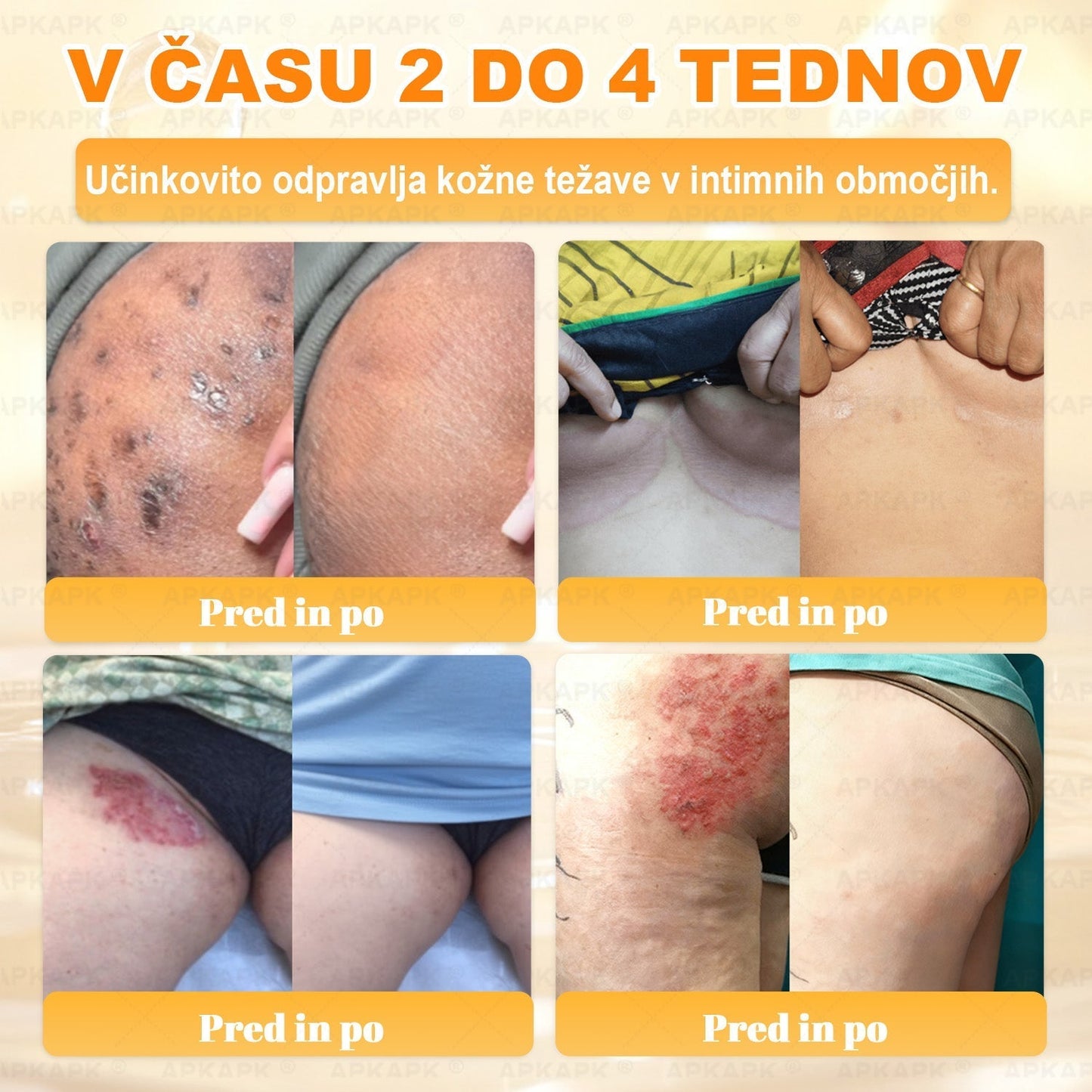 🎁 Na voljo je samo še 5 paketov! Zdaj prejmete dodatnih 50% popusta! Ostanite zdravi. Če te priložnosti ne izkoristite zdaj, bo naslednja šele prihodnje leto!