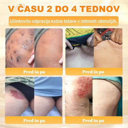 🎁 Na voljo je samo še 5 paketov! Zdaj prejmete dodatnih 50% popusta! Ostanite zdravi. Če te priložnosti ne izkoristite zdaj, bo naslednja šele prihodnje leto!