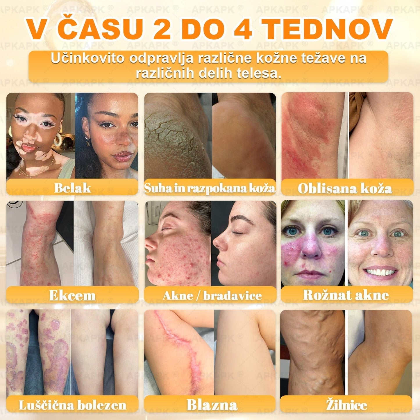 🎁 Na voljo je samo še 5 paketov! Zdaj prejmete dodatnih 50% popusta! Ostanite zdravi. Če te priložnosti ne izkoristite zdaj, bo naslednja šele prihodnje leto!