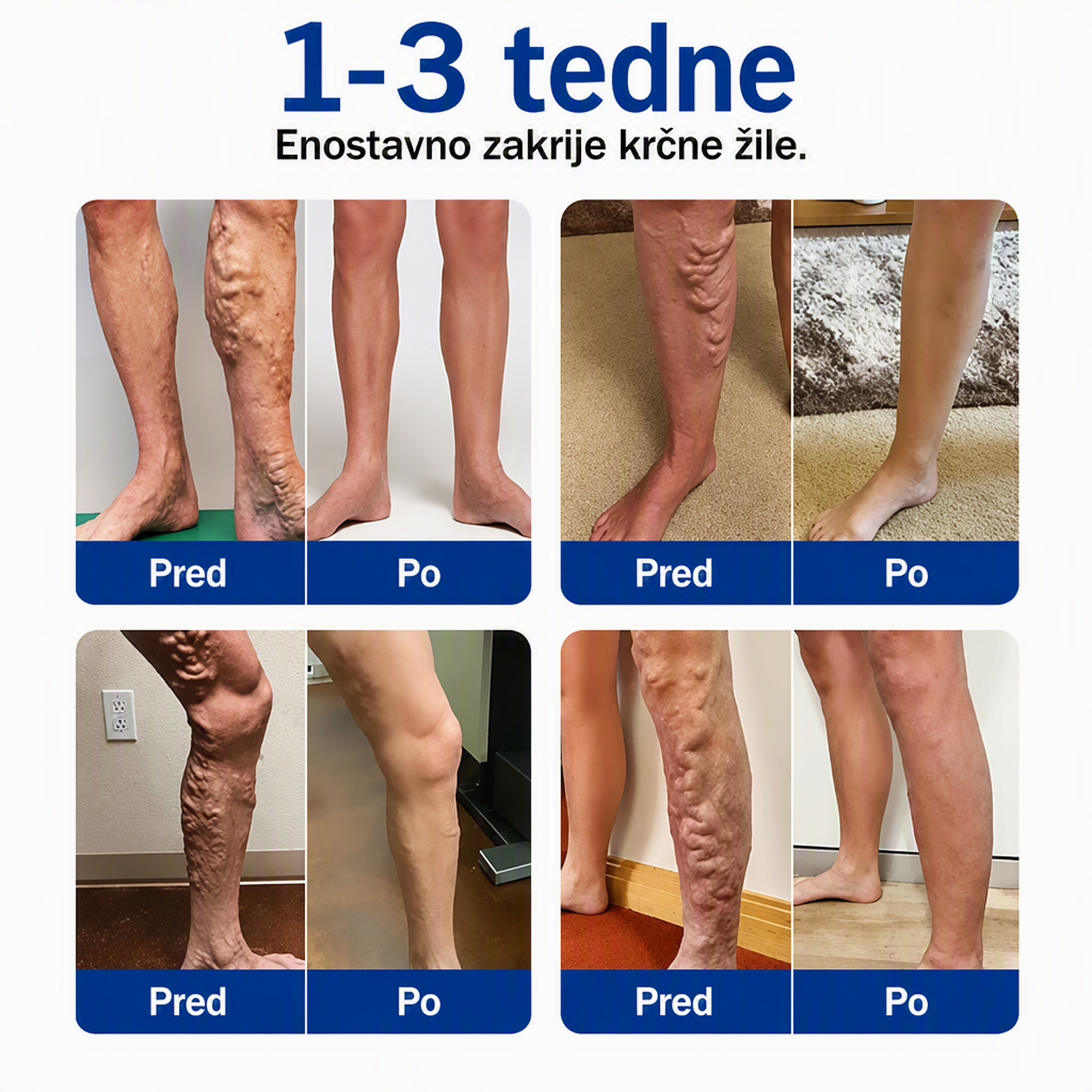 🎉 SAMO DANES – IZJEMNA PONUDBA! 🔥 Dodajte še eno pakiranje obližev FFBSI® za nego nog in prejmite TUDI 50‑ODSTOTNI POPUST! ✨ ⭐ Več obližev – lažje nadaljujete z redno nego nog! 💚 ⏰ Ne zamudite – ponudba velja omejen čas!