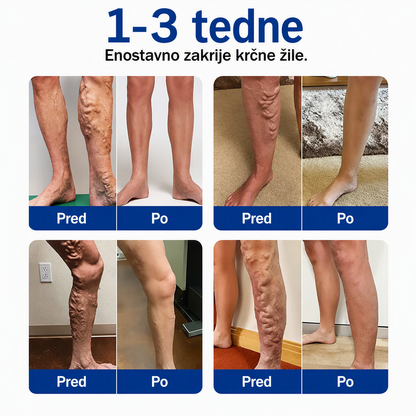 🎉 SAMO DANES – IZJEMNA PONUDBA! 🔥 Dodajte še eno pakiranje obližev FFBSI® za nego nog in prejmite TUDI 50‑ODSTOTNI POPUST! ✨ ⭐ Več obližev – lažje nadaljujete z redno nego nog! 💚 ⏰ Ne zamudite – ponudba velja omejen čas!