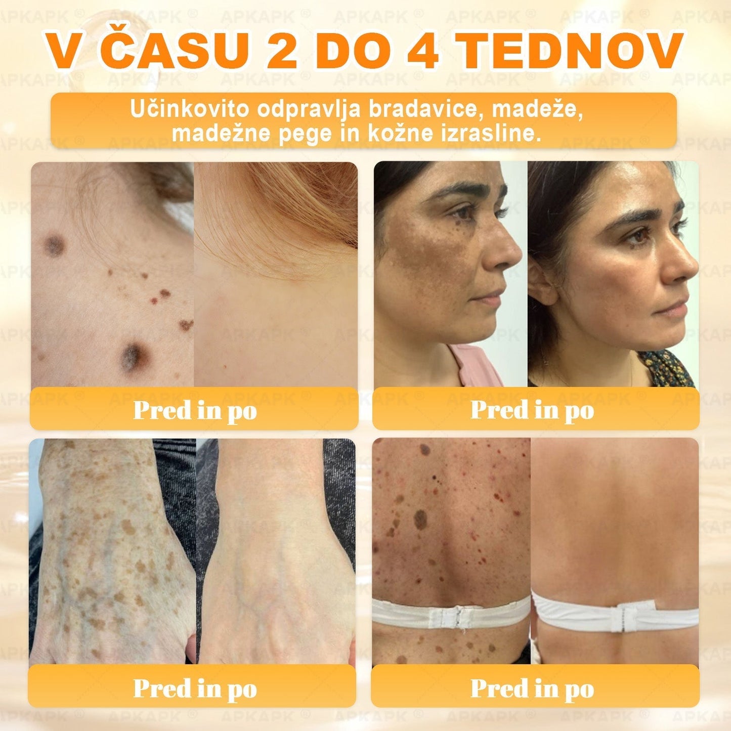 🎁 Na voljo je samo še 5 paketov! Zdaj prejmete dodatnih 50% popusta! Ostanite zdravi. Če te priložnosti ne izkoristite zdaj, bo naslednja šele prihodnje leto!