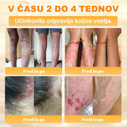 🎁 Na voljo je samo še 5 paketov! Zdaj prejmete dodatnih 50% popusta! Ostanite zdravi. Če te priložnosti ne izkoristite zdaj, bo naslednja šele prihodnje leto!